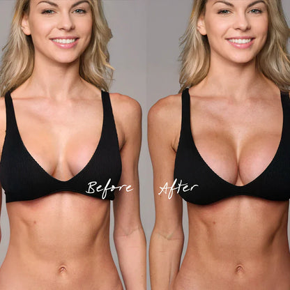 Invisible Lift Inserts